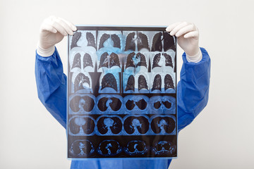 Doctor surgeon in protective uniform check up x ray film of MRI lungs scan. Coronavirus Covid 19,...