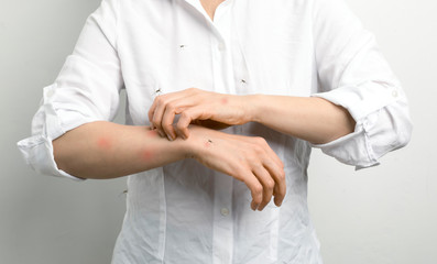 A person itches after mosquito bites. - obrazy, fototapety, plakaty