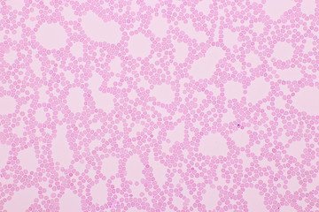 Red blood cells in blood smear, Wright-Giemsa stain, analyze by microscope, 400x