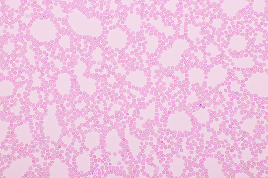 Red blood cells in blood smear, Wright-Giemsa stain, analyze by microscope, 400x