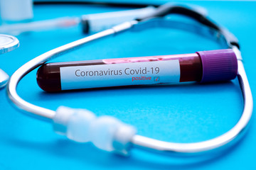 Coronavirus Covid-19 outbreaking. Medicine and epidemic concept. Tube with positive blood test result, protective face mask, medication pills, stethoscope, vial and syringe, vaccine in laboratory