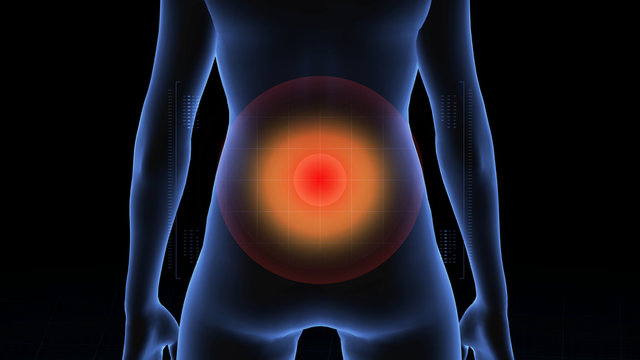 Girl with pathology. 3d body of women. Female human figure.