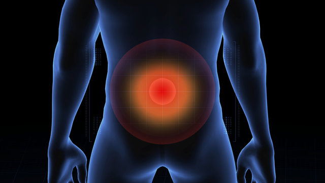 Man with pathology. 3d body of boy. Male human figure.