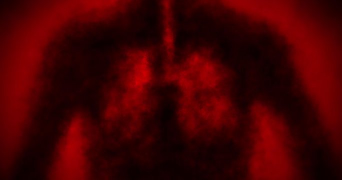 The microbe penetrates the human body. Pneumonia and hospitalization of a person. Work apparatus artificial ventilation of the patient. Animation in black and red background.