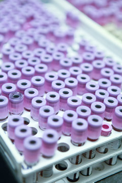 Lab Tests