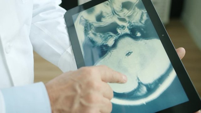 Close-up of doctor's hand touching tablet screen with MRI results of patient looking at skull images making diagnosis. Medicine and modern technology concept.