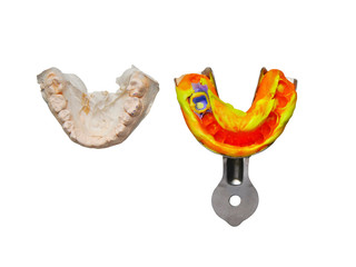 dental spatula with print for dental implant . dental spatula and plaster cast of implanted teeth. dental spatula with an impression for the dental crown isoleted on white background.