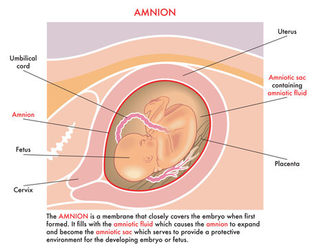 Amnion | Radiology Reference Article | Radiopaedia.org