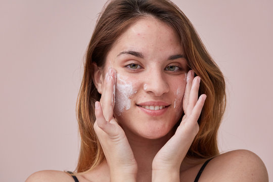skin care for pimples