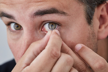 Man inserting contact lens