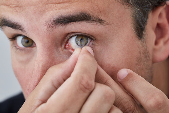 Man inserting contact lens