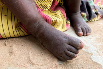 Barefoot Child in a Rural African Village