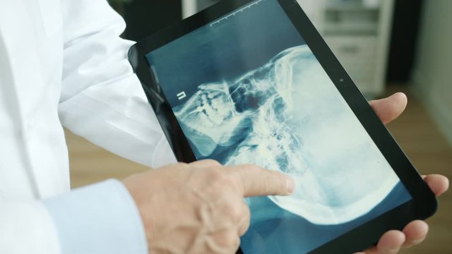 Close-up of doctor's hands in uniform touching tablet screen looking at skull x-ray working in office alone. Medicine, modern technology and people concept.