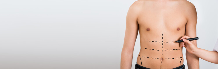 Person Hands Drawing Correction Lines On Abdomen