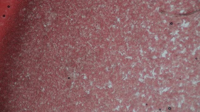 Fresh blood seen on a microscope view. Blood smear under microscope present plasma, white and red blood cells.