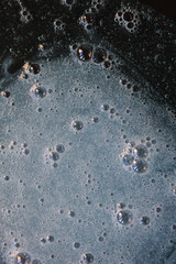 Blue hyaluronic acid gel