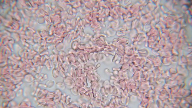Red blood cells under microscope, seen on 1000x. Movement of objects.