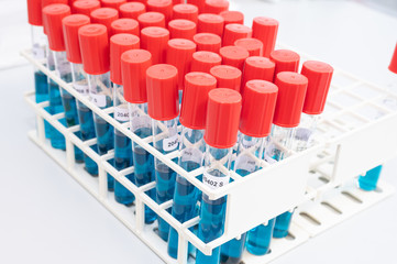 Fototapeta premium laboratory tubes with blue liquid and red cap stand in a stand in a laboratory for salmonella