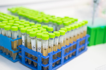 centrifuge tubes in a medical laboratory