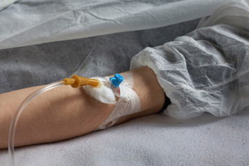 A peripheral venous catheter is inserted into a vein on the arm.