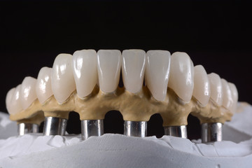artificial dentition and instruments in a dental laboratory