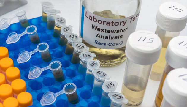 Wastewater samples, analysis of sars-cov-2 virus in patients infected by human coronavirus 229E, conceptual image