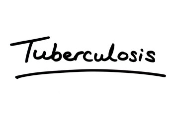 Tuberculosis