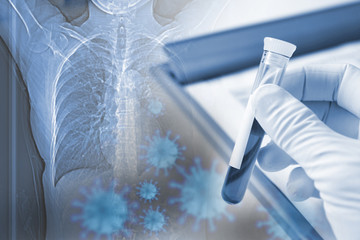 医療イメージ　世界的な感染症の流行と治療