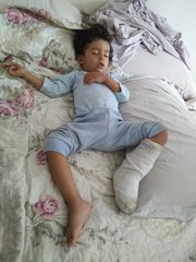 Bebê fraturado
