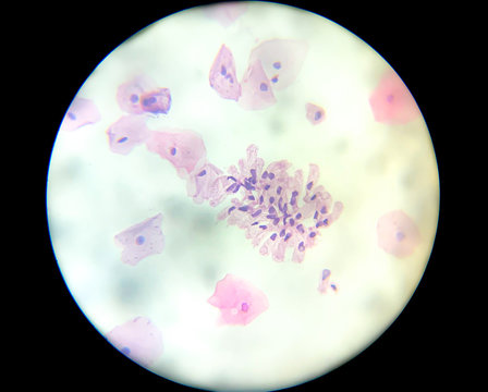 Cytological examination using the liquid base method