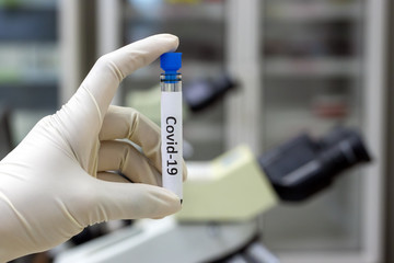 Research of virus in the lab. Hand in glove holding a test tube with the inscription covid-19 in a laboratory. Sample with blood.