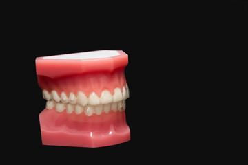 Inivisalign braces, transparent aligner, invisible retainer or orthodontic silicone trainer. A way to have a beautiful smile with teeth model.