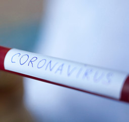 Obraz premium Blood test tube. Testing for Coronavirus disease.