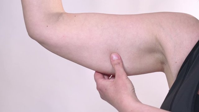 Middle-aged overweight woman holding a hand with excess fat. On a white background, Isolated.