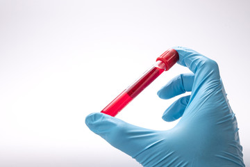 Chemistry laboratory research blood test tube and examination gloves, medical and science concept