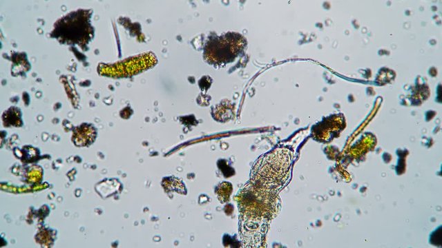 A large rotifer worm feeds between algae and mud in a drop of water under a microscope. Theme of laboratory biological research under microscope. Microscopic protozoa in a drop of water magnification.