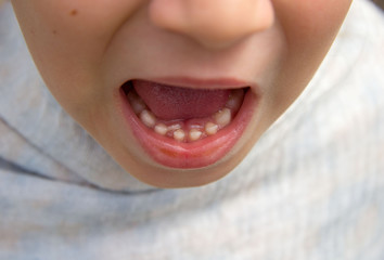 the child's root teeth, which grow next to the milk teeth. Teeth grow in two rows. These are the...