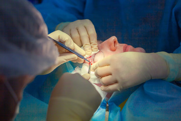 Close up of surgeons hands performing an incision on the upper eyelid of the patient starting the blepharoplasty operation