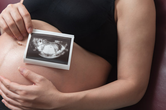 Close up of pregnant woman holding the ultrasound picture of her baby, side vie