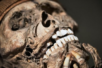 Skull part of a mummified body