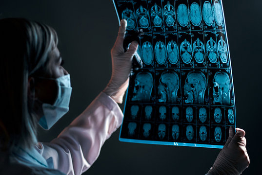 A female doctor in a mask examines an X-ray or MRI scan of a patient’s brain scan isolated on a dark gray background.