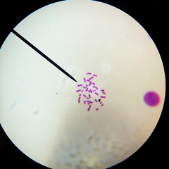 Human chromosomes under a microscope
