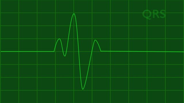 EKG Heartbeat on Monitor Recording of Pulse - green line Rendered HD SD video