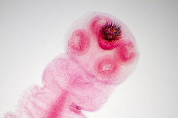 The suckers and hooks of a young tapeworm.