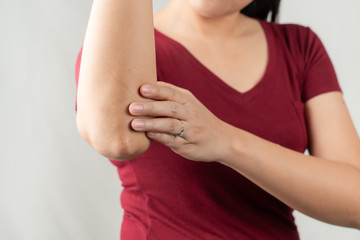 elbow pain, young women injuredm, healthcare and medical concept