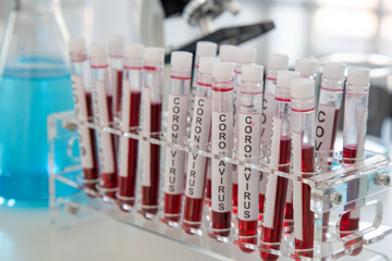 Close-Up on Covid 19 Vaccine on Laboratory Tube With Blood And Virus at Scientific Lab background.