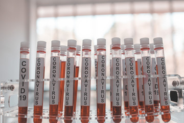 Close-Up on Covid 19 Vaccine on Laboratory Tube With Blood And Virus at Scientific Lab background.