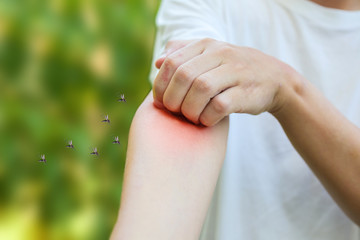 Man itching and scratching on arm from allergy skin rash cause by Mosquitoes bite