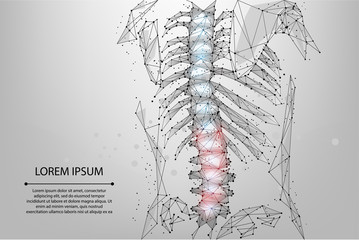 Abstract mesh line and dot physiotherapy human spine. Low poly Pain area surgery operation. Polygonal render female back hernia vector illustration - obrazy, fototapety, plakaty