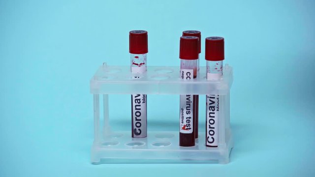 cropped view of doctor putting test tubes with coronavirus lettering on blue